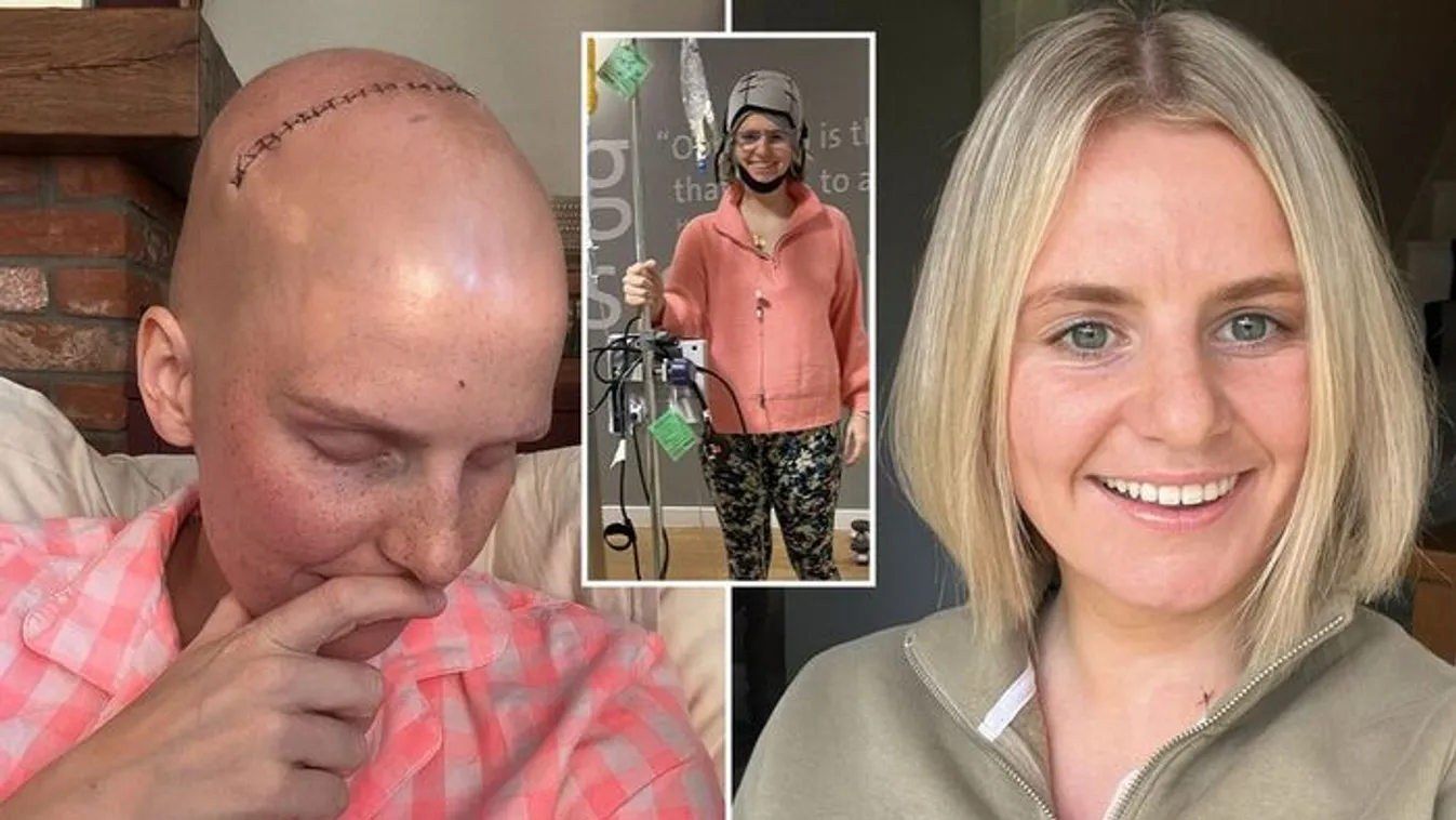 27 évesen lett mellrákos fiatal, de a háziorvosa elküldte