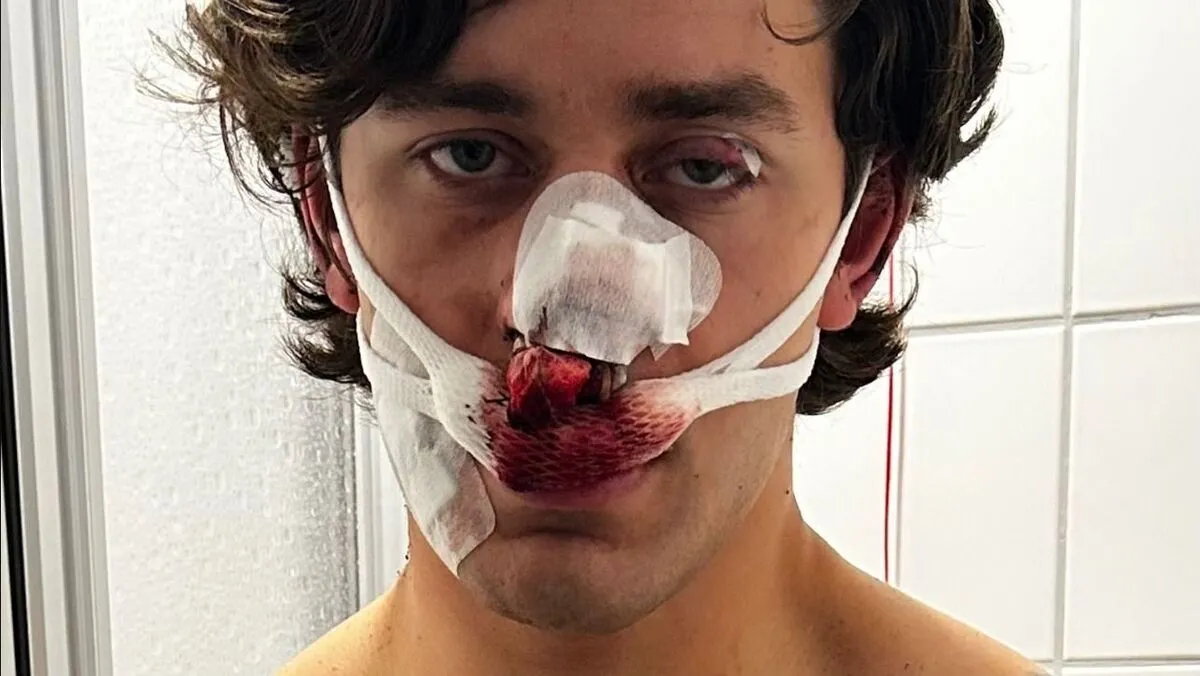 A szörnyű támadás során súlyos sérüléseket szerzett a hős turista. 