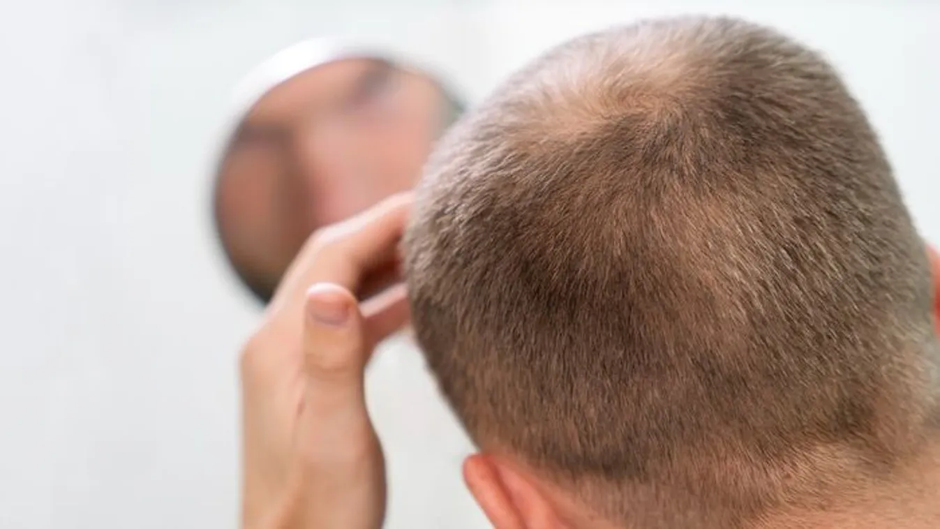 Hajbeültetés alatt halt meg egy férfi