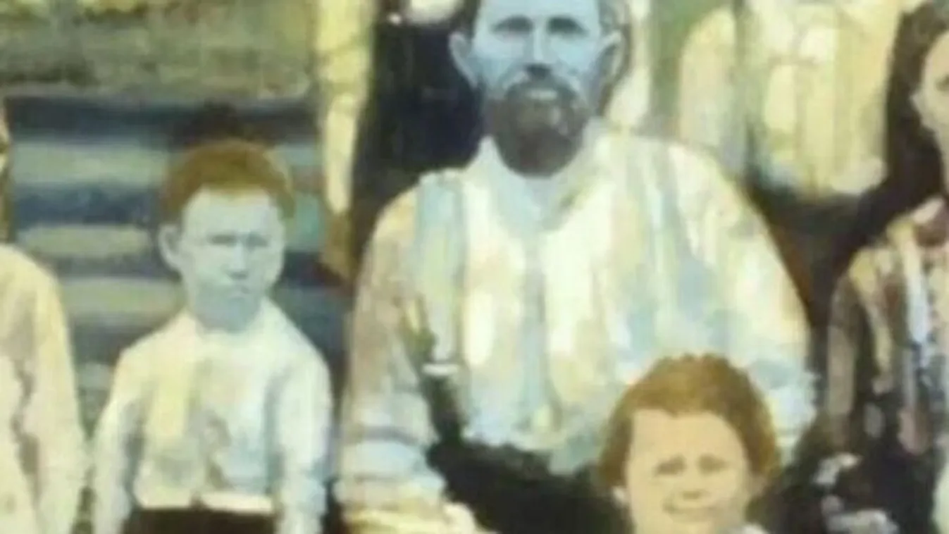 Gyomorfogató rejtély oldódott meg: ez a 200 éves betegség, amelyet a kék bőrű család beltenyészet útján örökített tovább