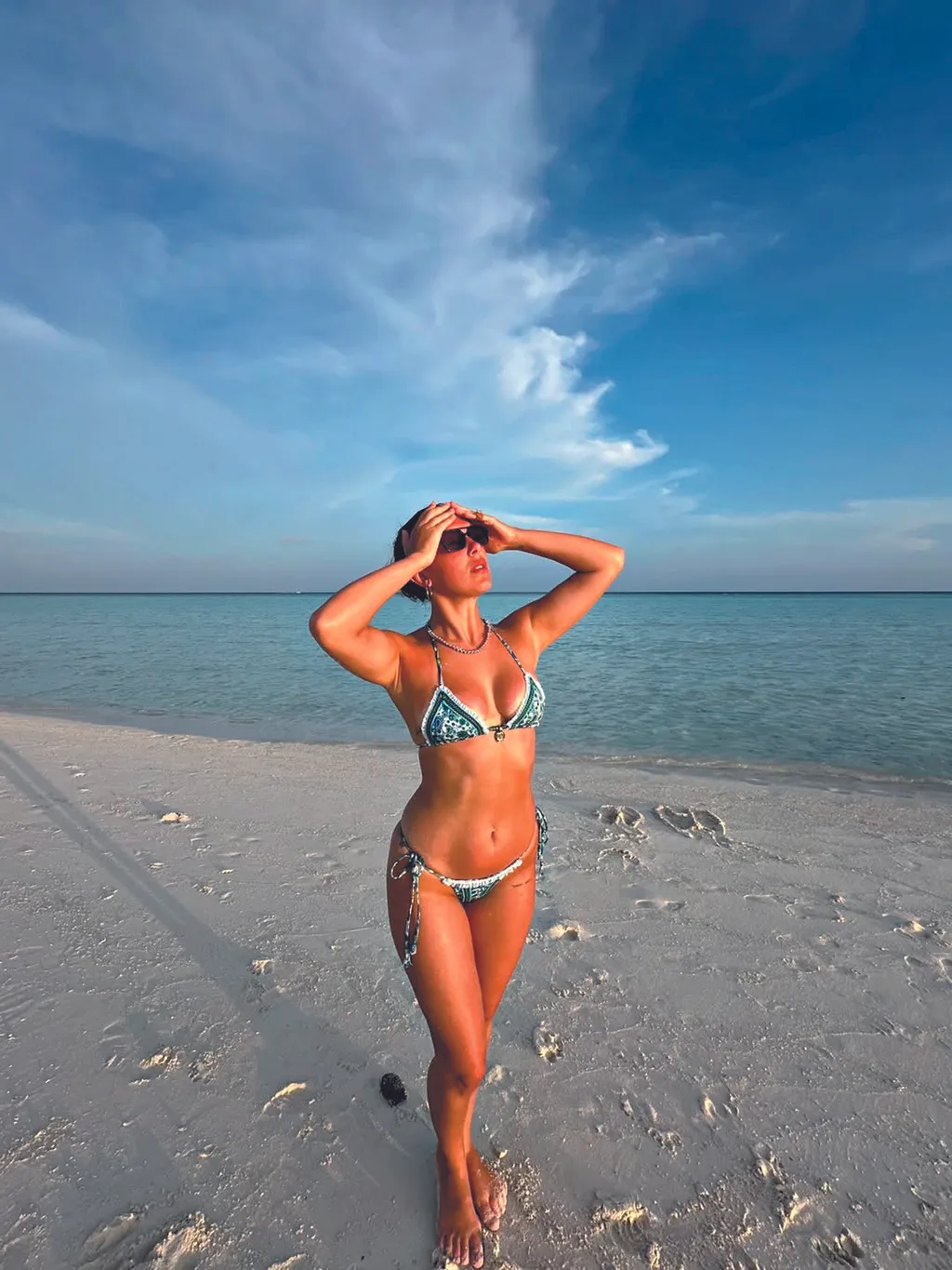 Galéria: Sztárok, akik pirosra égtek a napon - RIPOST