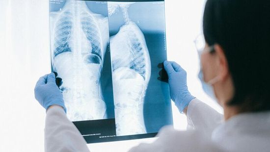 „Azt hittem, influenzás vagyok, de hetek múlva agresszív rákkal küzdöttem”