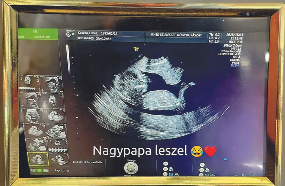 MC Hawer szeptemberben nagypapa lesz, még ízlelgeti ezt a helyzetet   RIPOST
