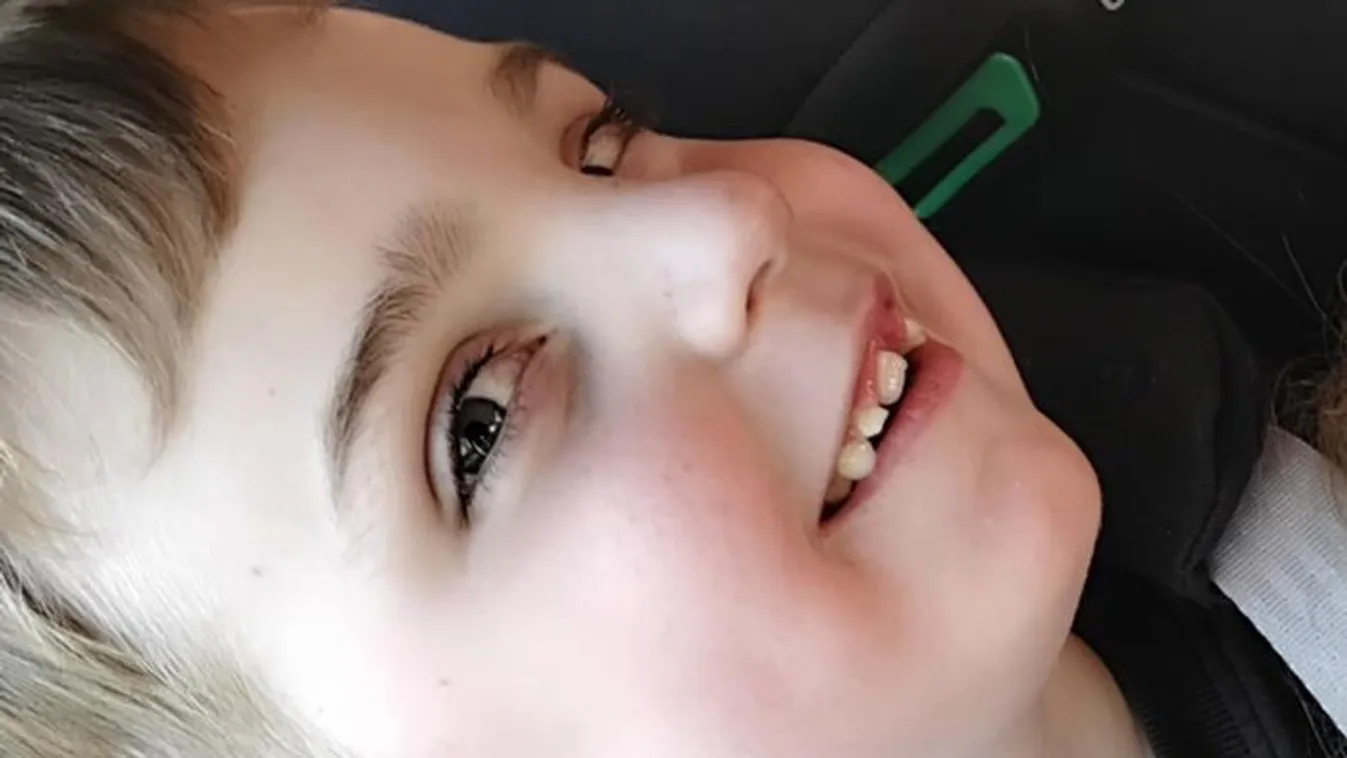 Futással támogatják az esőgyerek Zsombi gyógyulását