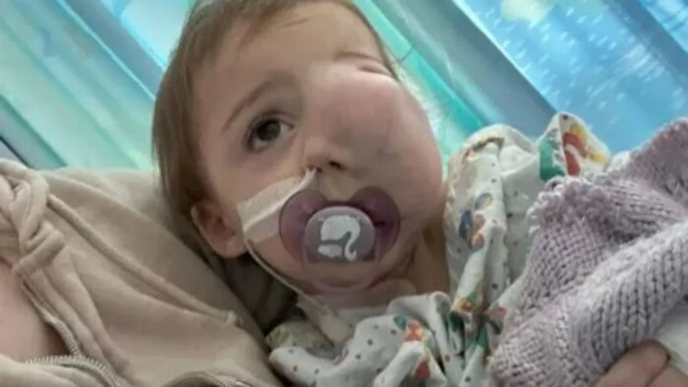 Csak 1 évet élhetett, rákban elhunyt egy édes kislány