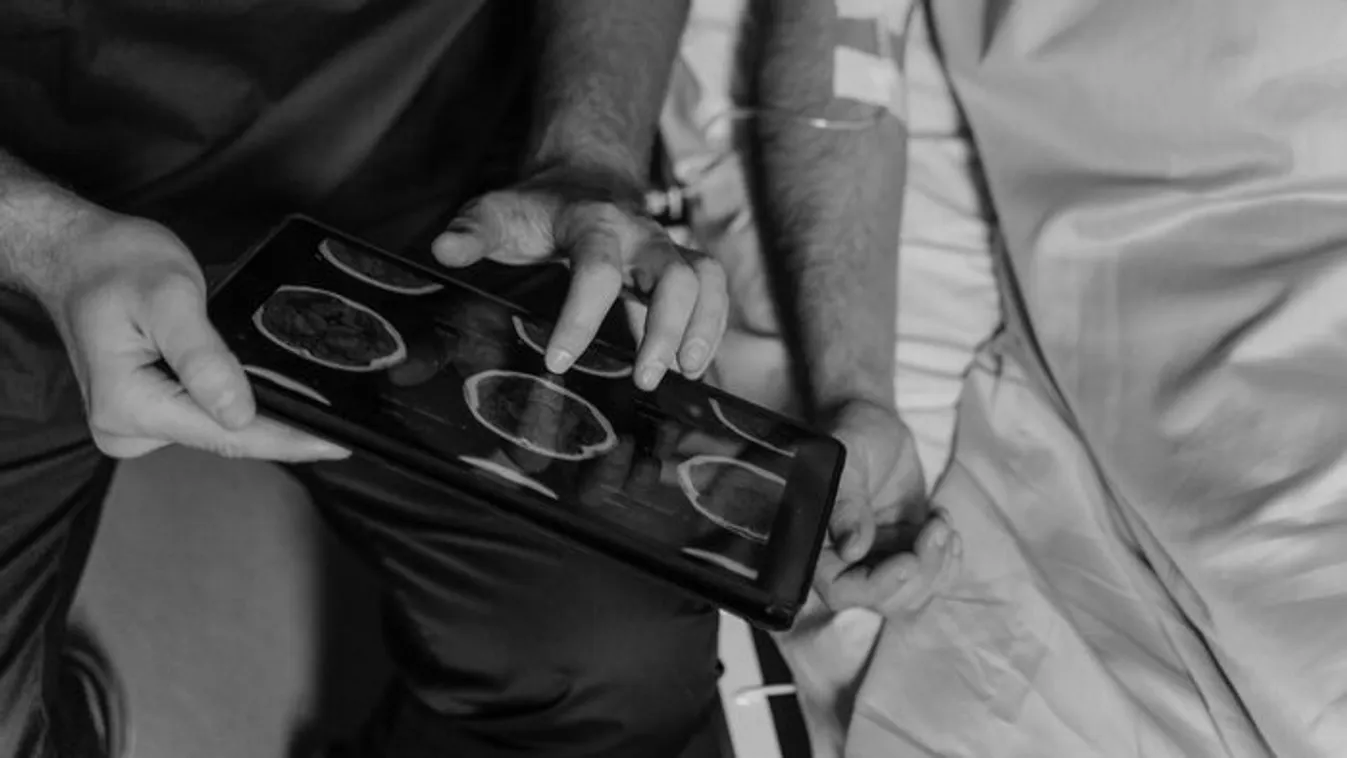 24 évesen diagnosztizáltak 3. stádiumú rákot a fiatal nőnél