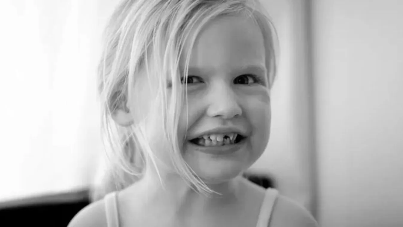  Kegyetlen betegséggel küzd egy kislány