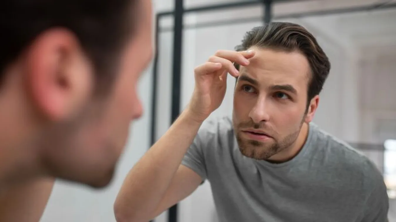 Csínján ezekkel az italokkal: kopaszodáshoz vezethetnek!