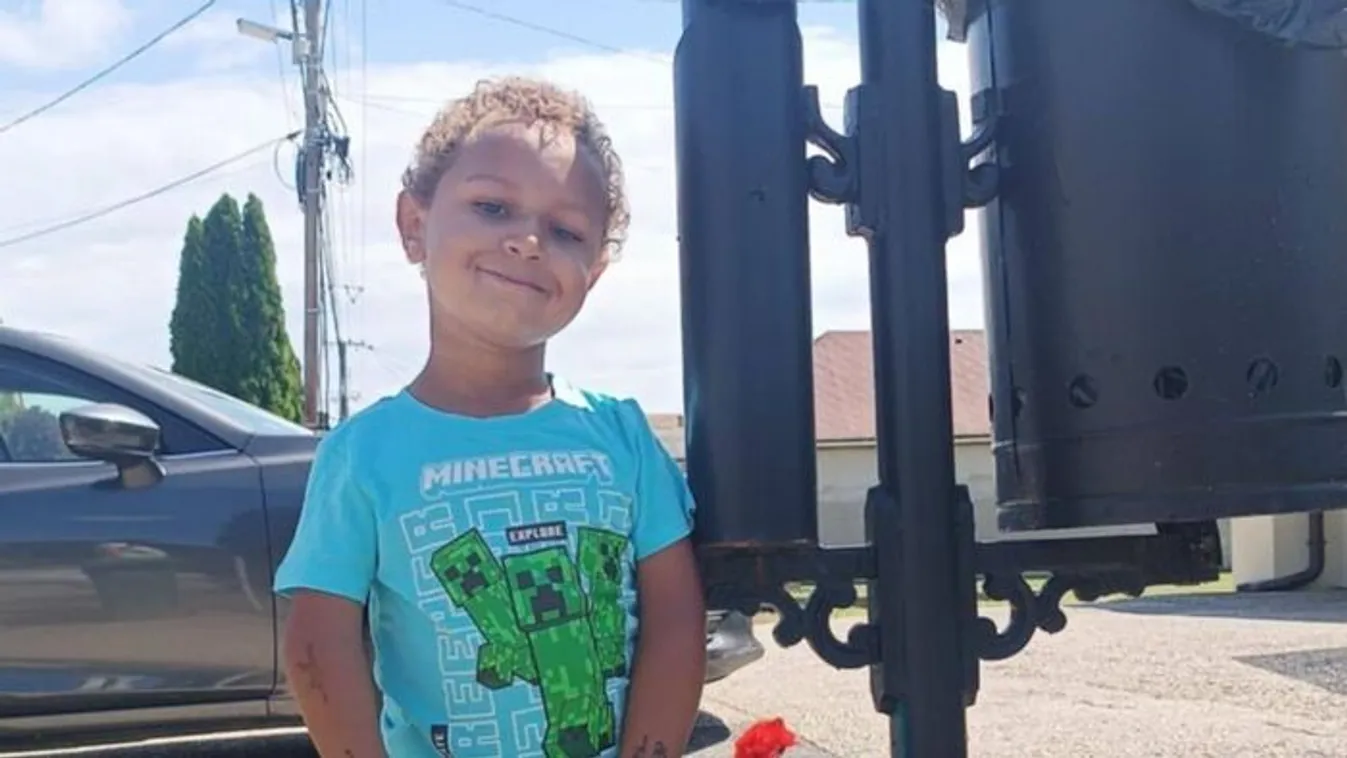 Műtétek sora vár a kis Noelre