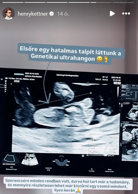Henry Kettnerék genetikai ultrahangon jártak