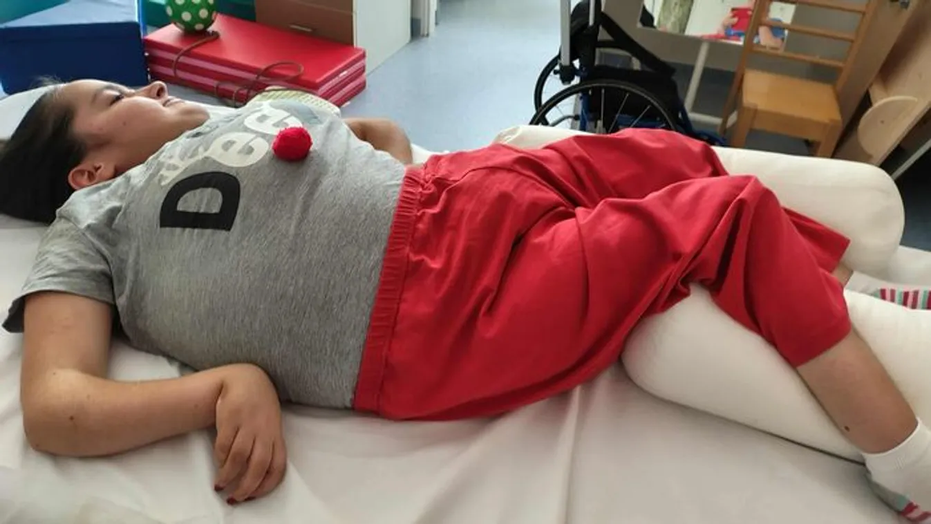 Cintia születésekor háromszor kapott agyvérzést