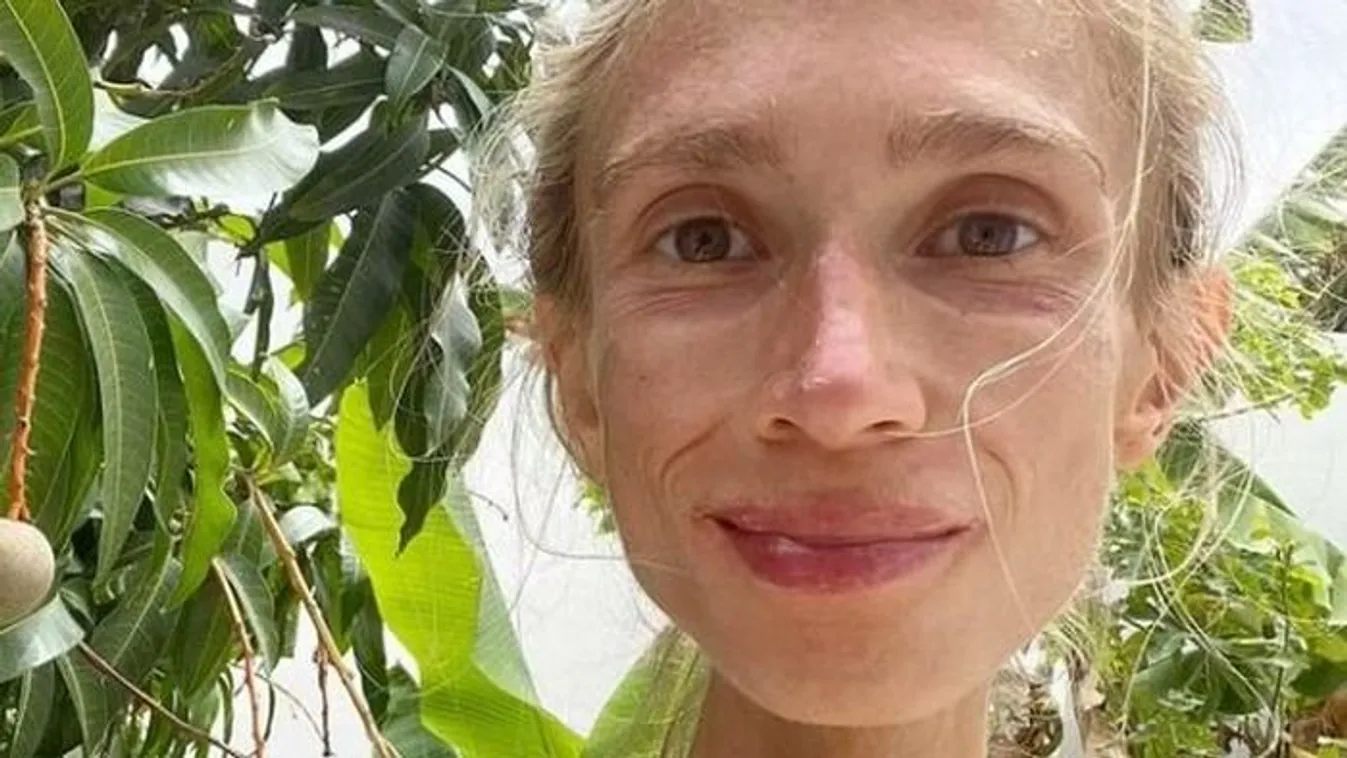 Éhen halt egy 27 éves nő, miután egy bizarr diétára váltott