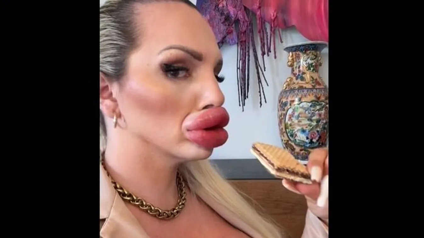 "Nekem vannak a világon a legnagyobb ajkaim"