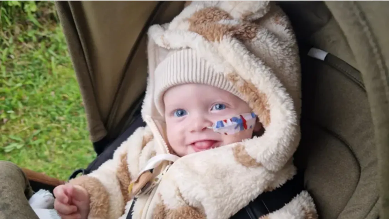 Egy csecsemő orrdugulása egy szörnyű betegséget rejtett