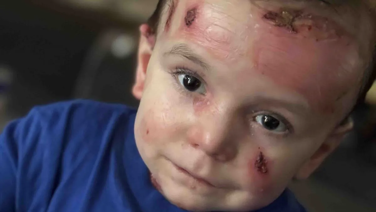 Felvonulást szerveztek a beteg gyereknek