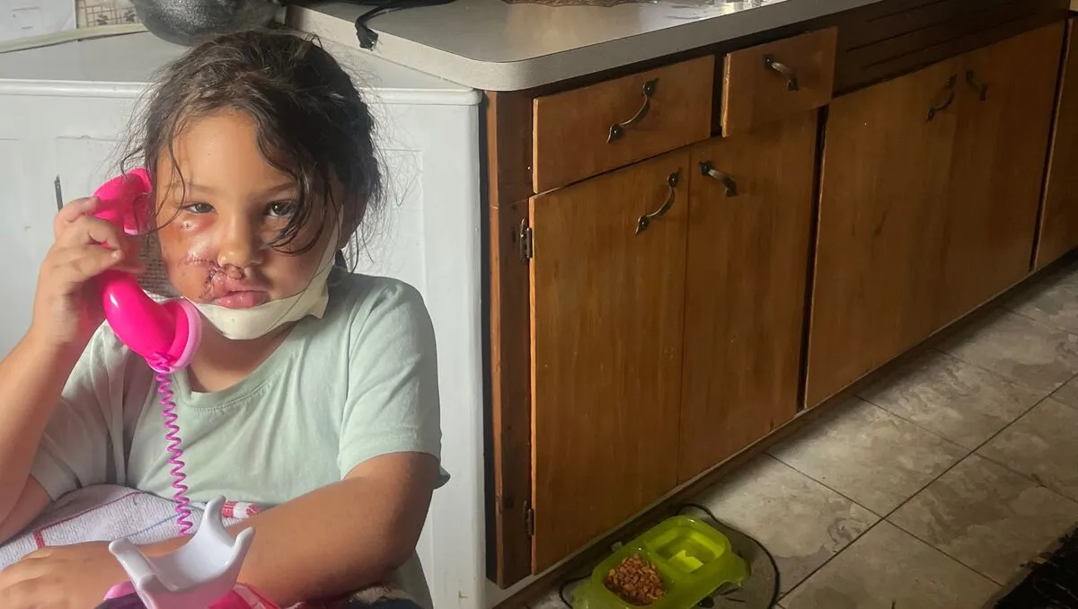 A kutyatámadás traumatizálta a családot