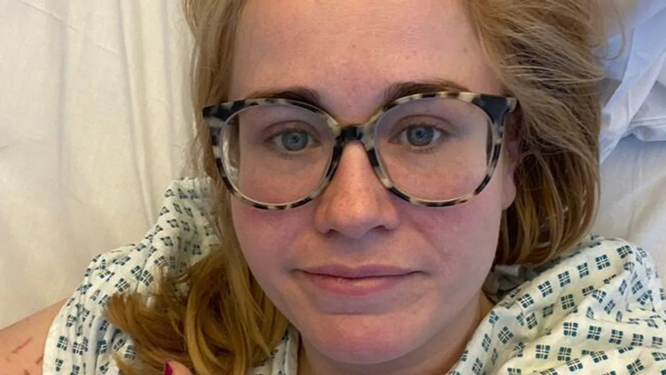 „Azt hittem, csak migrénem van – aztán paradicsompiros lett a bőröm!”