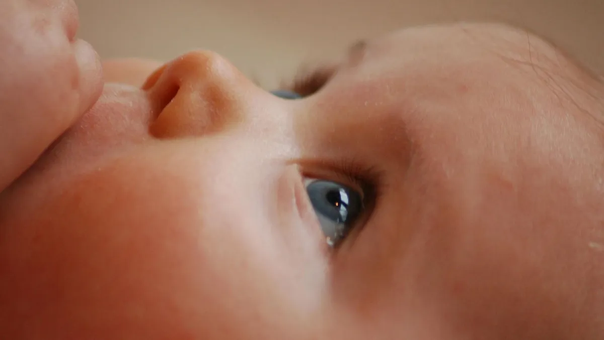 Szemrákkal diagnosztizálták az egyéves kislányt. 