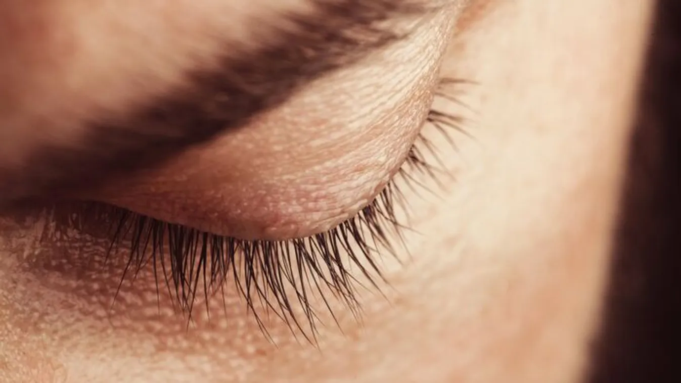 Egy nő először azt hitte bele ment valami a szemébe