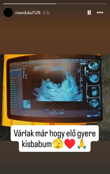 Mandula Ádám hihetetlen dolgot jelentett be