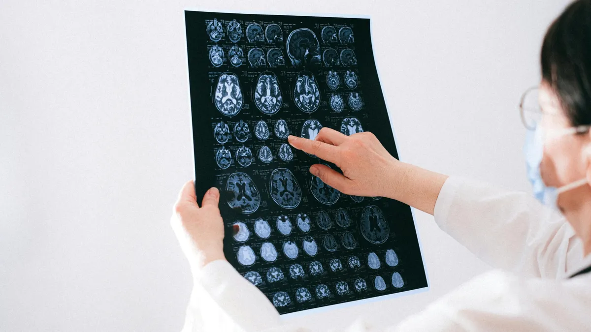 Agydaganatot diagnosztizáltak a 4 éves kisfiúnál