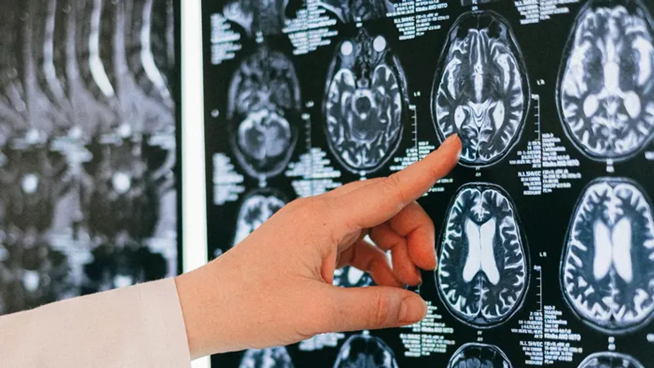 Már a gondolatainkat is olvassa a mesterséges intelligencia