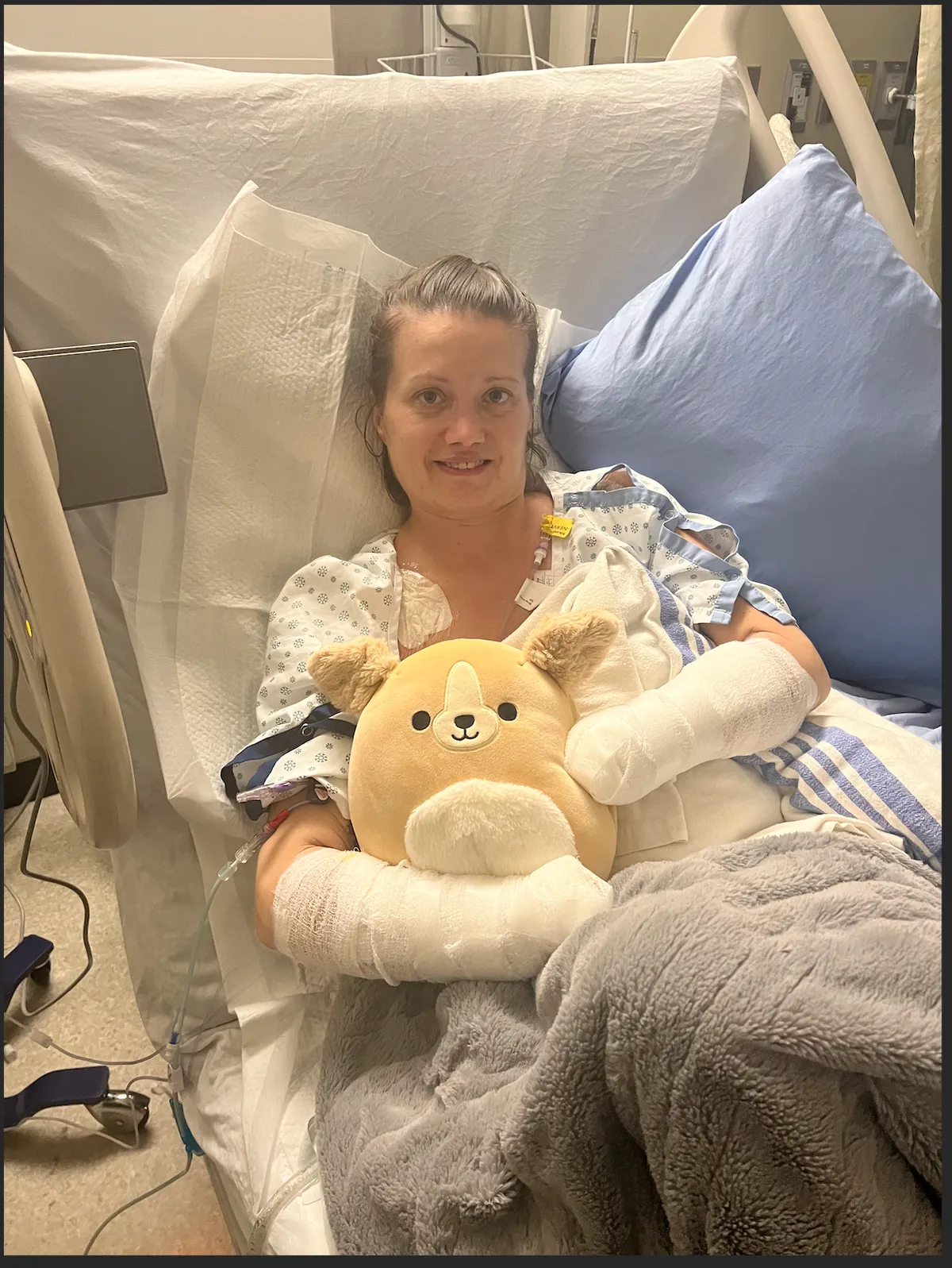 Négyszeres amputáció mentette meg a nő életét