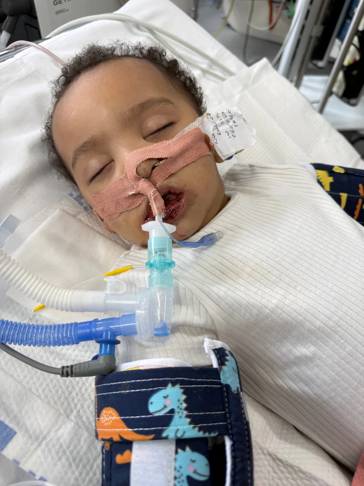 Tej helyett lefolyótisztítót ivott a kisfiú