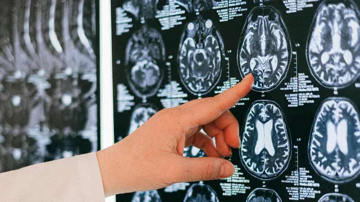 Már a gondolatainkat is olvassa a mesterséges intelligencia