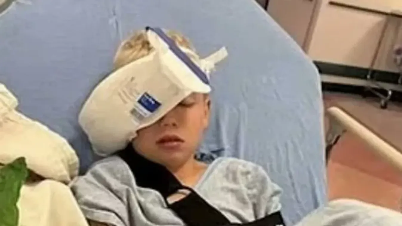 Tragédia az iskolában: 8 éves fiúra omlott a mennyezet