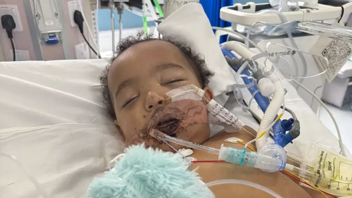 Lefolyótisztítót ivott a 13 hónapos gyerek