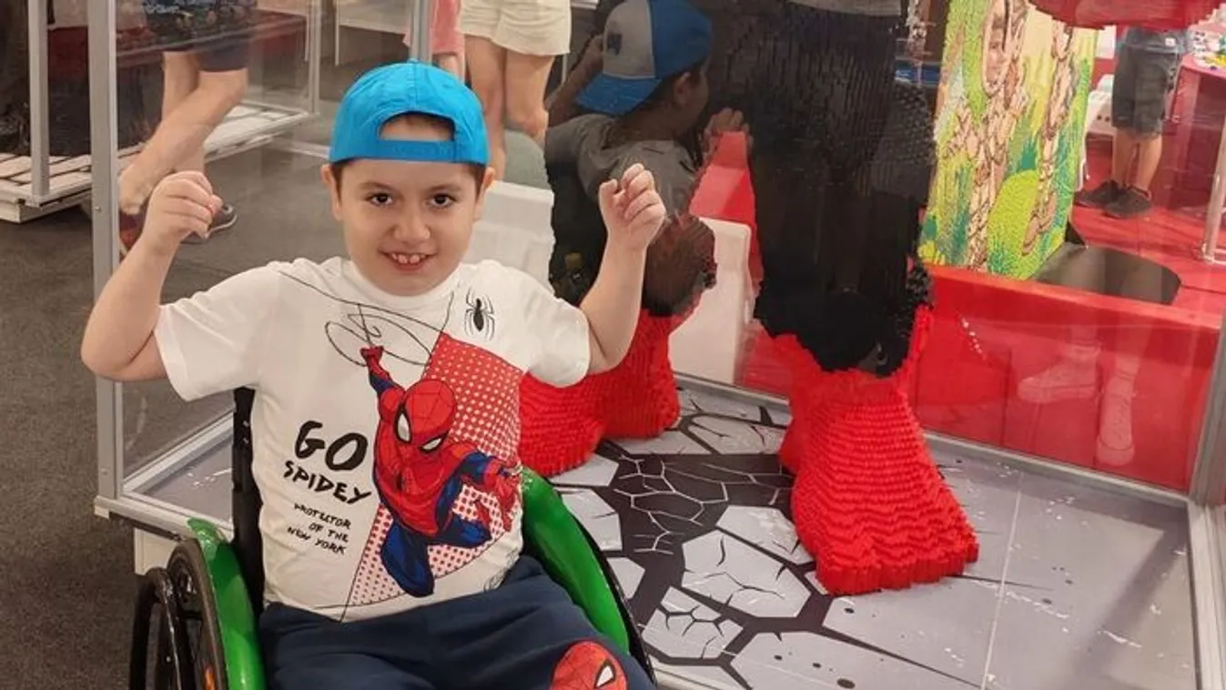 10 éves kisfia izomsorvadása ellen küzd Viktória