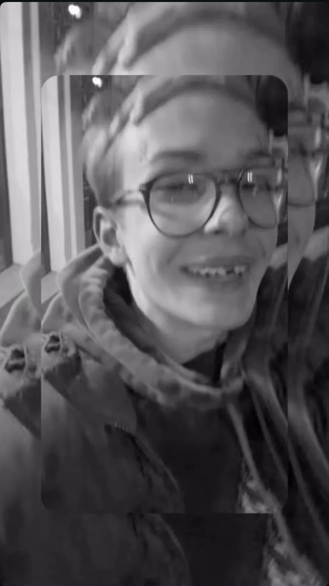 Alee hiányzó foggal vékony arccal látható új fotóján