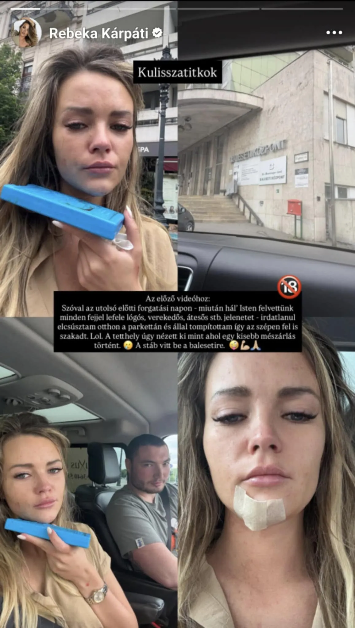 Kárpáti Rebeka a Baleseti Sebészeten kötött ki.