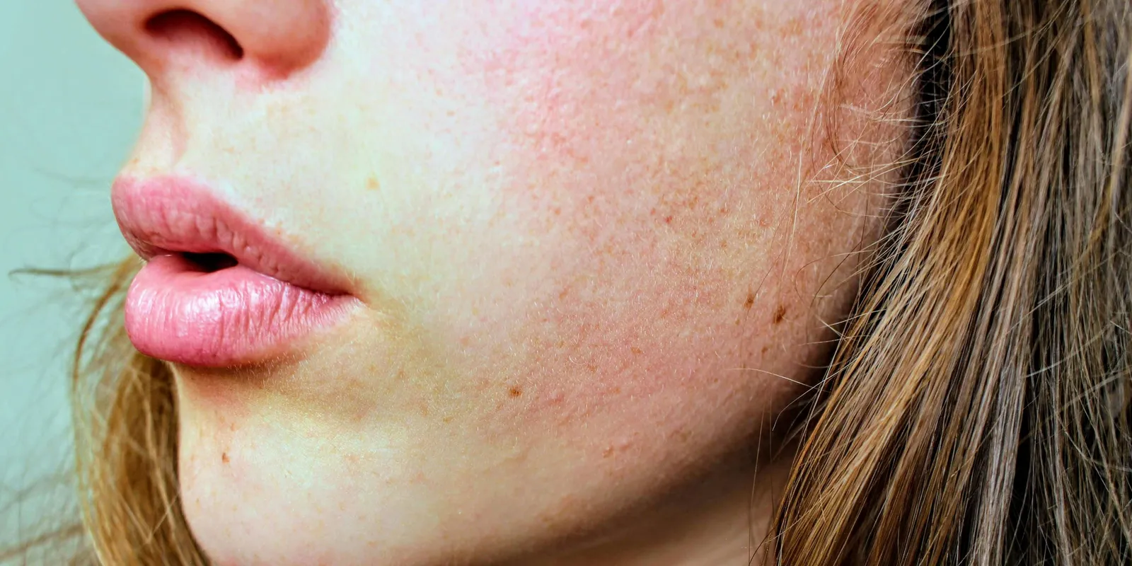 Bőrparaziták sokaságával küzd egy édesanya minden nap