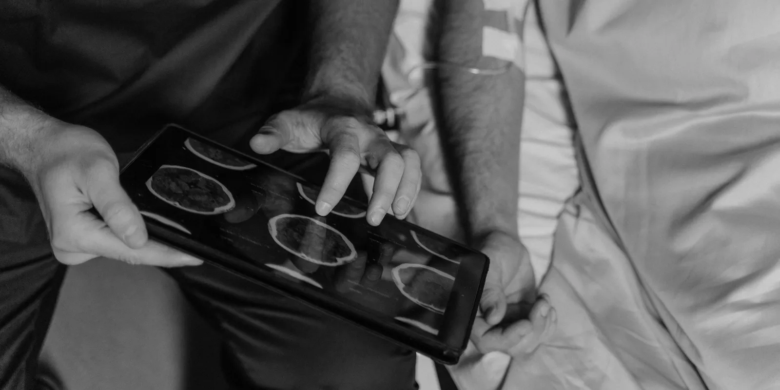 Nem minden rákos megbetegedést kell azonnal kezelni