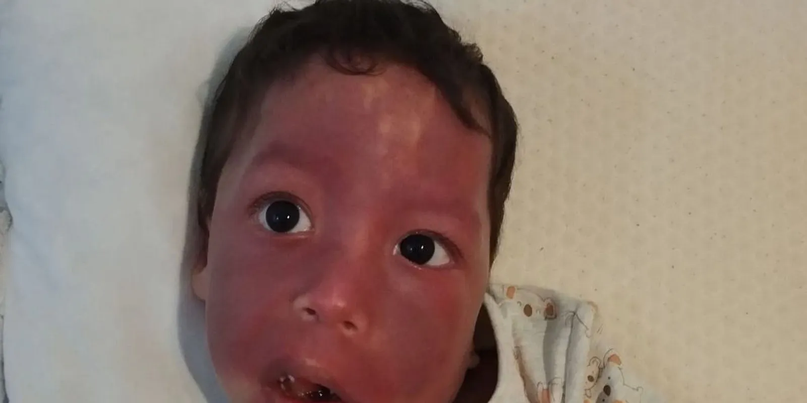 Halálos epilepszia ellen küzd az 5 éves Ábel