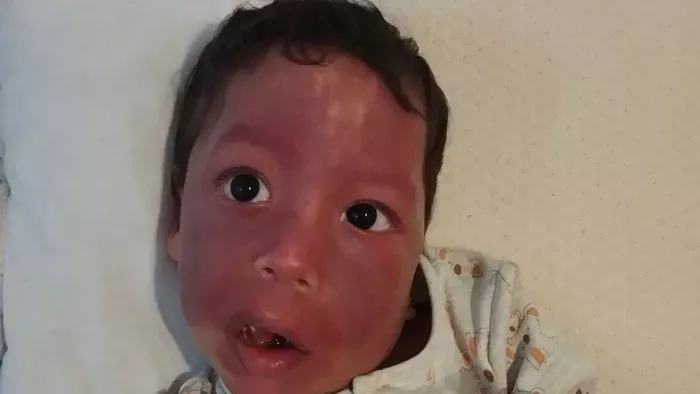 Halálos epilepszia ellen küzd az 5 éves Ábel