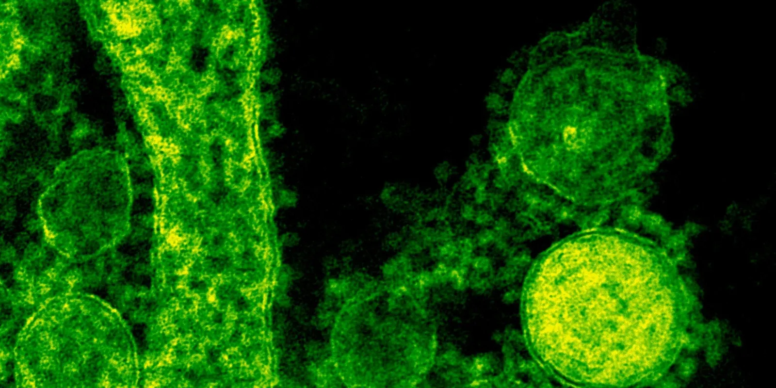 Fertőző gyilkos gombára figyelmeztetnek a tudósok