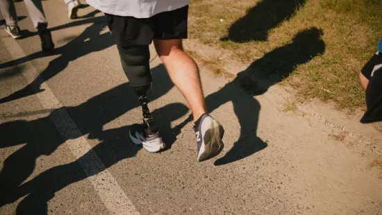 Egy férfi megépítette a saját lábprotézisét az amputációja után