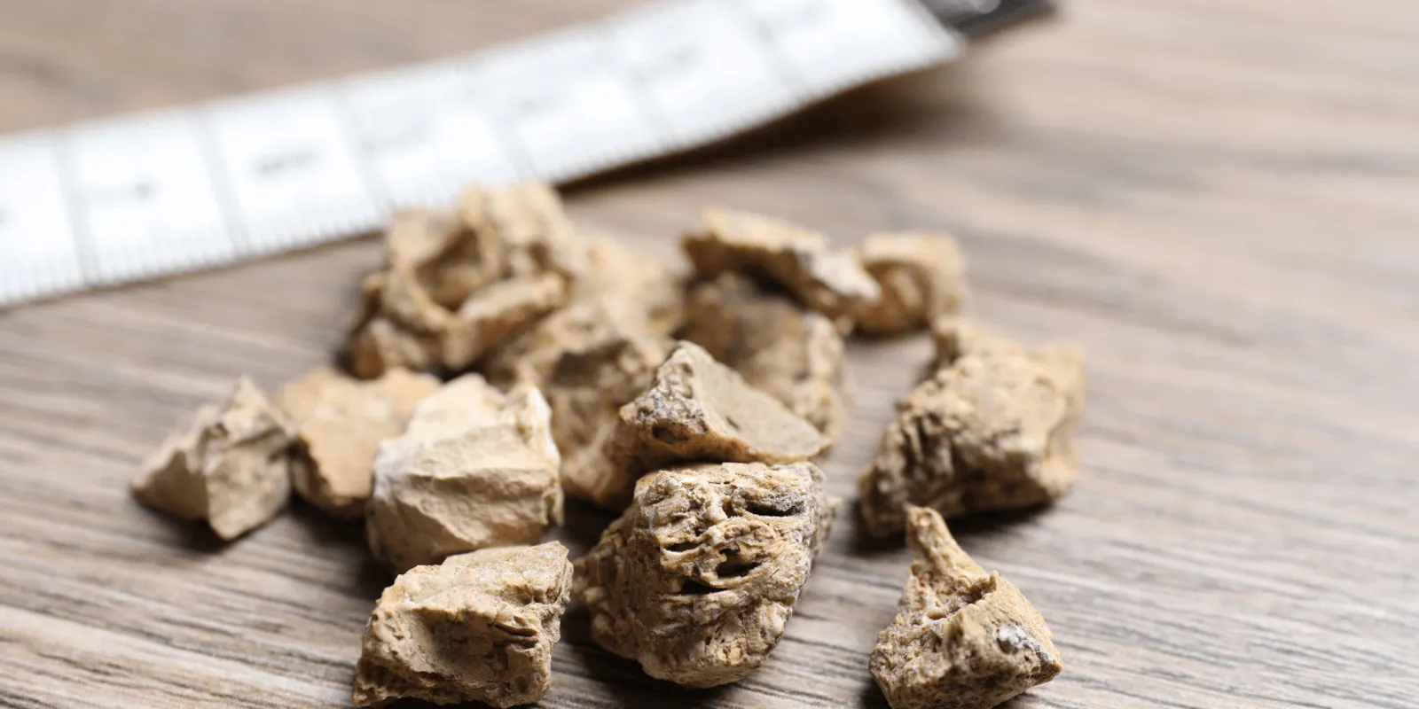 Drágakőnek hitték, de veseköveket loptak el az olasz betörők