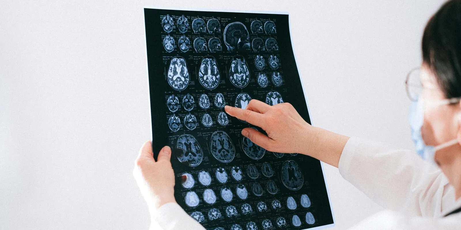  Különös tünet jelezte Livia súlyos betegségét