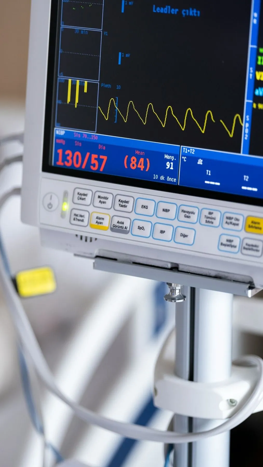 alt=A fiatal férfi egy új élet reményében kénytelen élni egy mesterséges szívvel a mellkasában