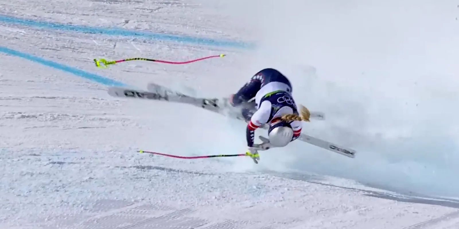 Megrázó szavak láttak napvilágot Lindsey Vonn kilátásairól