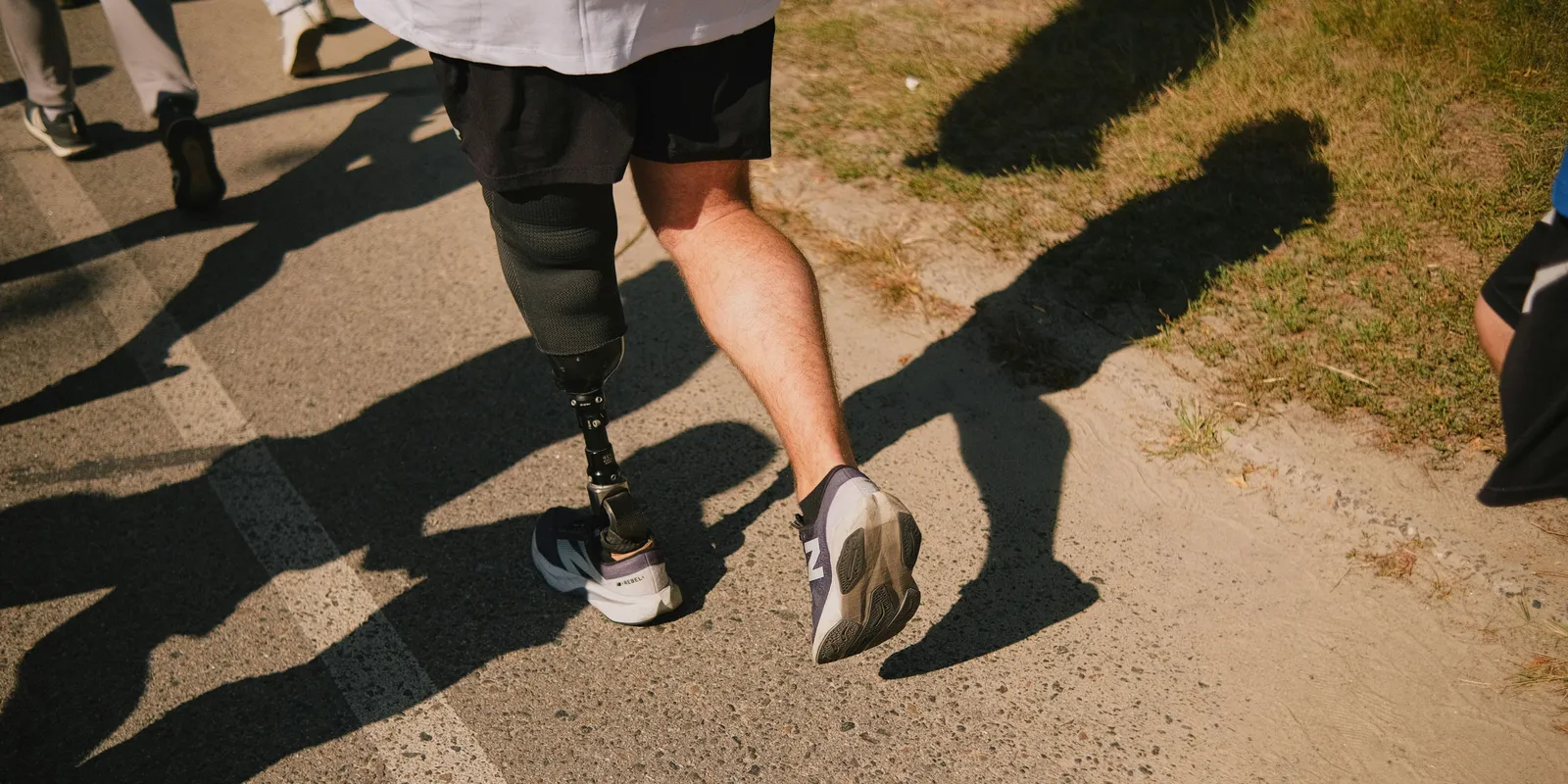 Egy férfi megépítette a saját lábprotézisét