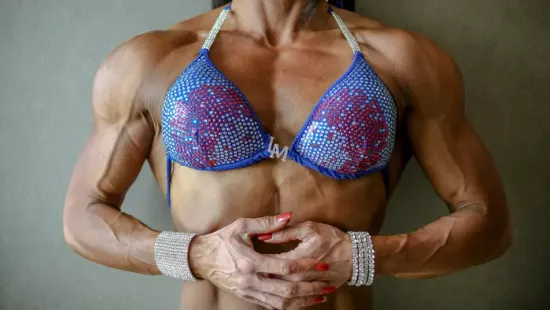 Egy nőnek a ritka betegsége miatt szinte lángol a lába, mégis testépítő versenyre készül