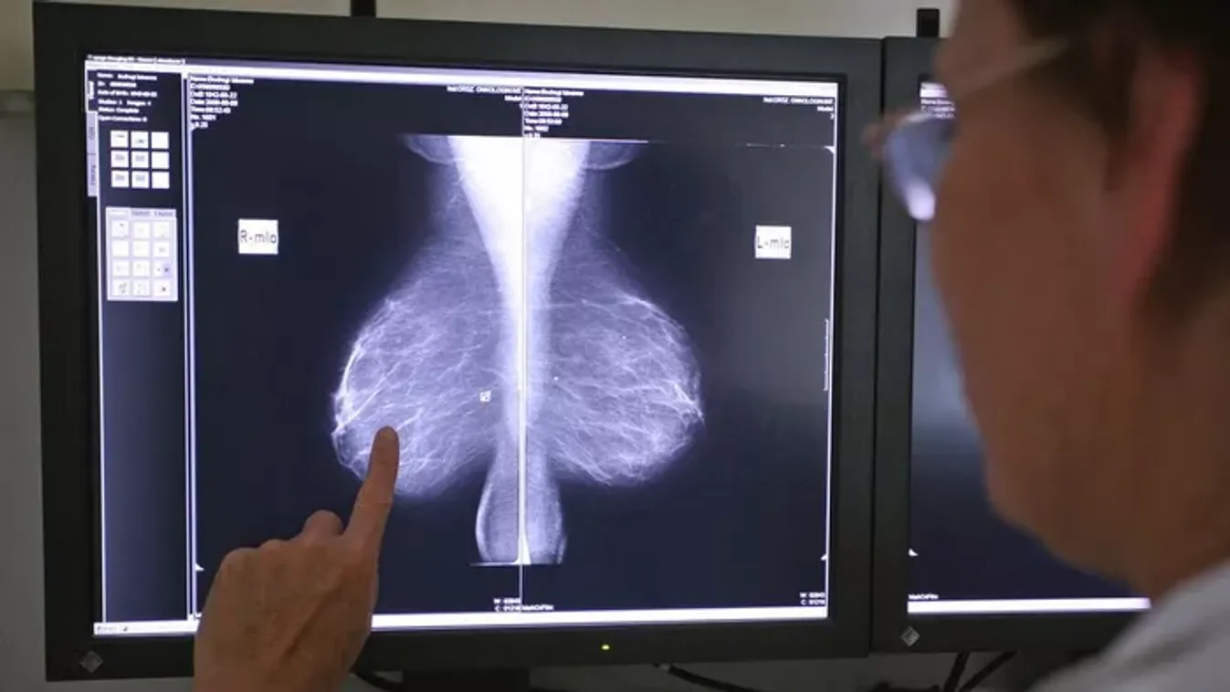 Kinek és milyen rákszűrésen ajánlott részt vennie? Mutatjuk!