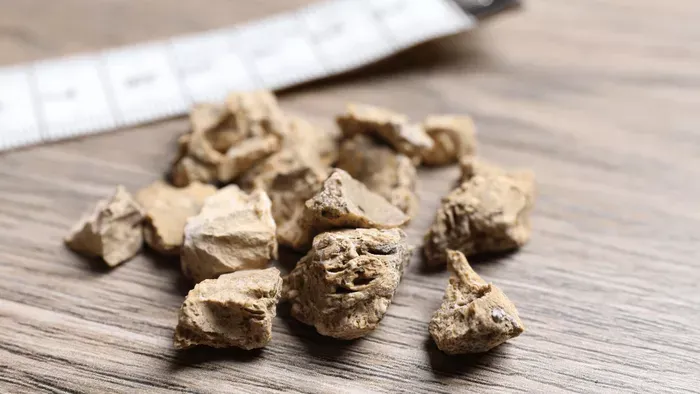 Drágakőnek hitték, de veseköveket loptak el az olasz betörők