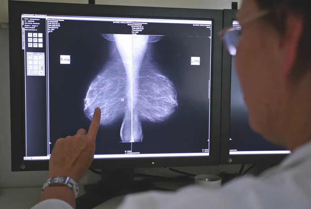 Rákszűrés leletét értelmezi egy orvos.