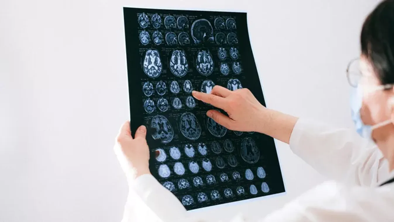  Különös tünet jelezte Livia súlyos betegségét